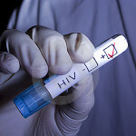 HIV+
